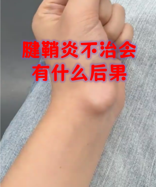 老司机开车!这些Windows11输入技巧治好了我的腱鞘炎